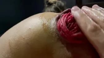 Monika Fox - Anal Prolapse Screwed by Gf