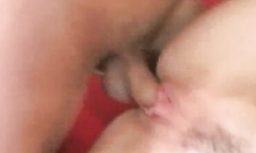 Alicia Alighatti Has Congenital Orbs