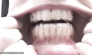 POV Babe Shows Off Plastic Retainer While Getting Stroked