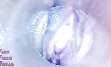 Asian MILF Gets Vaginal Endoscope Exam Again