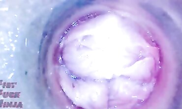 Asian MILF Gets Vaginal Endoscope Exam Again