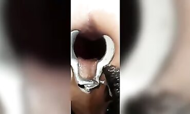 MistyMiMax Gets Fisted and Anal Fucked