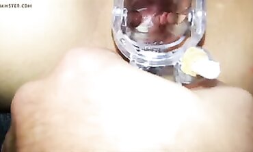 MILF Slutwife Gets Outdoor Speculum Play POV