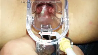 MILF Slutwife Gets Outdoor Speculum Play POV