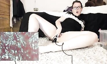 Medical Fetish - Endoscopic Exploration of Rectum with Dilated Probe