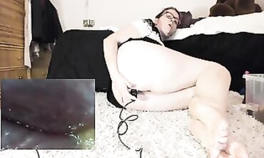 Medical Fetish - Endoscopic Exploration of Rectum with Dilated Probe
