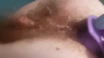 Petite Nurses' Secret Patient - Teen Pussy Stretched Open By Doctor For Treatment