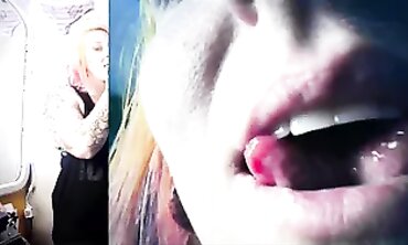 Vore Endoscopy
