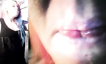 Vore Endoscopy
