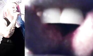 Vore Endoscopy
