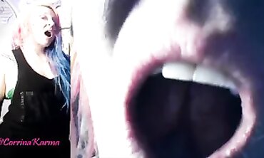 Vore Endoscopy